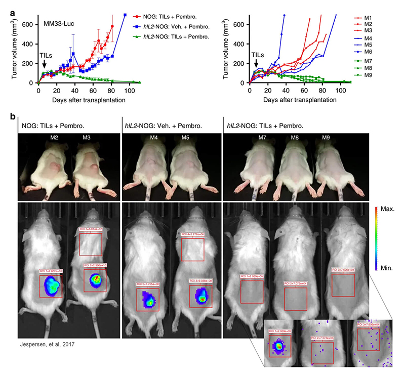 NOG mice expressing human IL-2 enable TIL-mediated tumor eradication