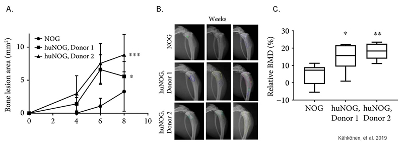 Human immune system increases breast cancer-induced osteoblastic bone growth in huNOG mice
