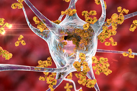 Illustration of antibodies attacking neuron