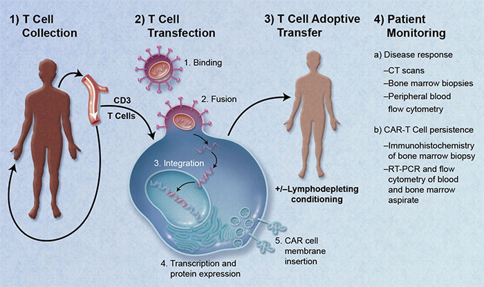 CAR Engineered T-Cell Adoptive Transfer