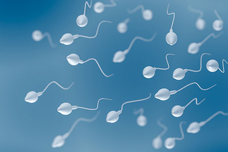 Sperm Cryopreservation Overview