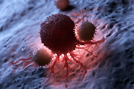 How Tumor Cells Escape T Cells